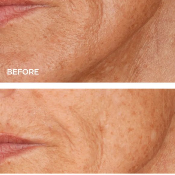 BeautyBio GloPRO® Microneedling Regeneration Head-to-Toe Glo Set - Picture 3 of 10